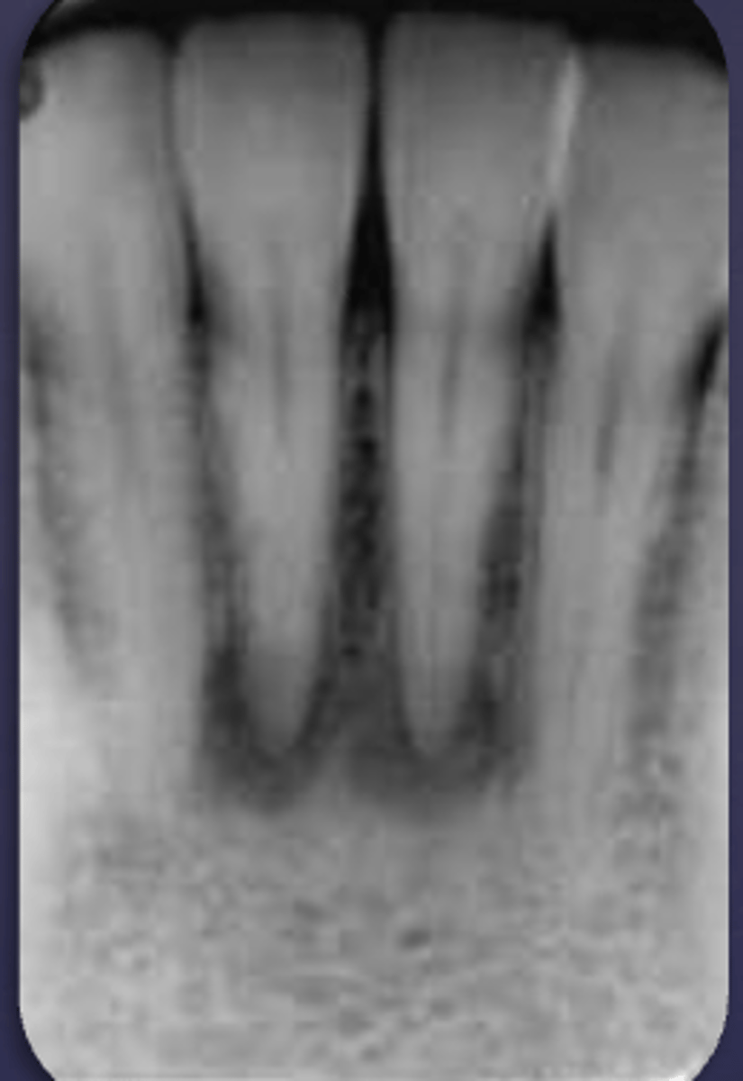 <p>What would be a differential diagnosis for this lesion?</p>
