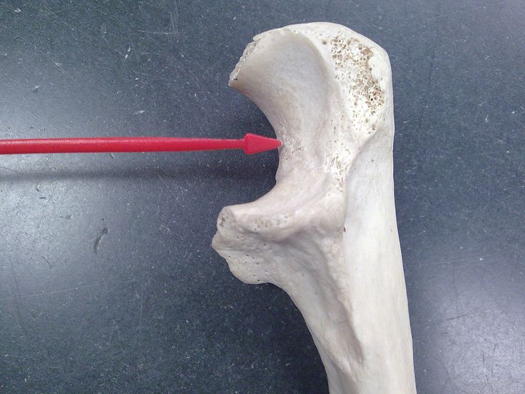 <p>What bone structure is this?</p>