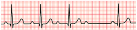<p>What rhythm is this?</p>