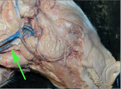 <p><span>The artery marked by the green arrow is the <strong>common carotid</strong> artery.</span></p>