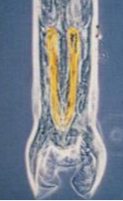 <p>What is this parasite</p>