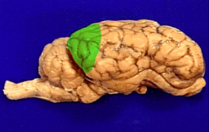 <p>Occipital lobe</p>