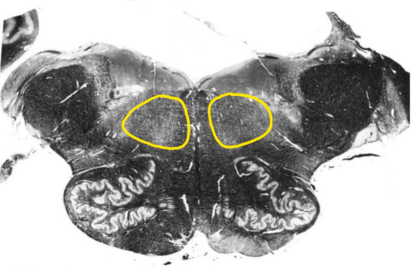 <p>ID the structure</p>