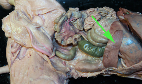 <p><span>The organ marked by the green arrow arrow is the <strong>Spleen</strong></span></p>