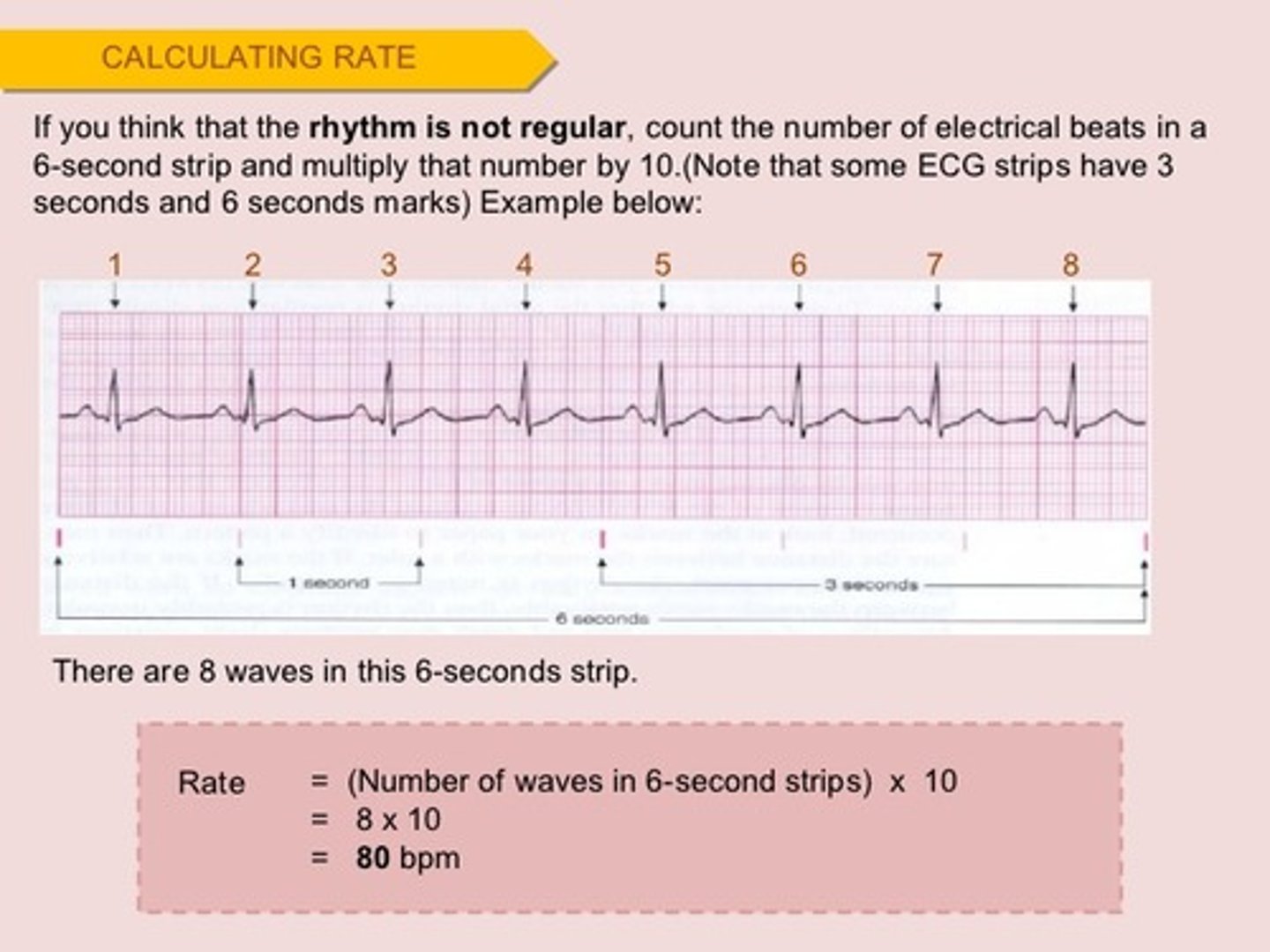 <p>Count number of R waves in a 6-second strip, multiply by 10 - this is the heart rate</p>