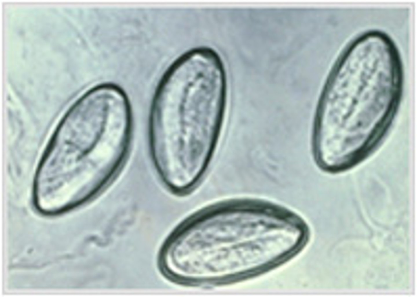 <p>Illustrated in this image is a field of view microscopically observed on a Scotch-tape preparation. Based on the morphology and presentation of these ova, an identification of Enterobius vermicularis can be made. The optimum time to obtain Scotch-tape samples of peri-anal skin to recover these ova is:</p>