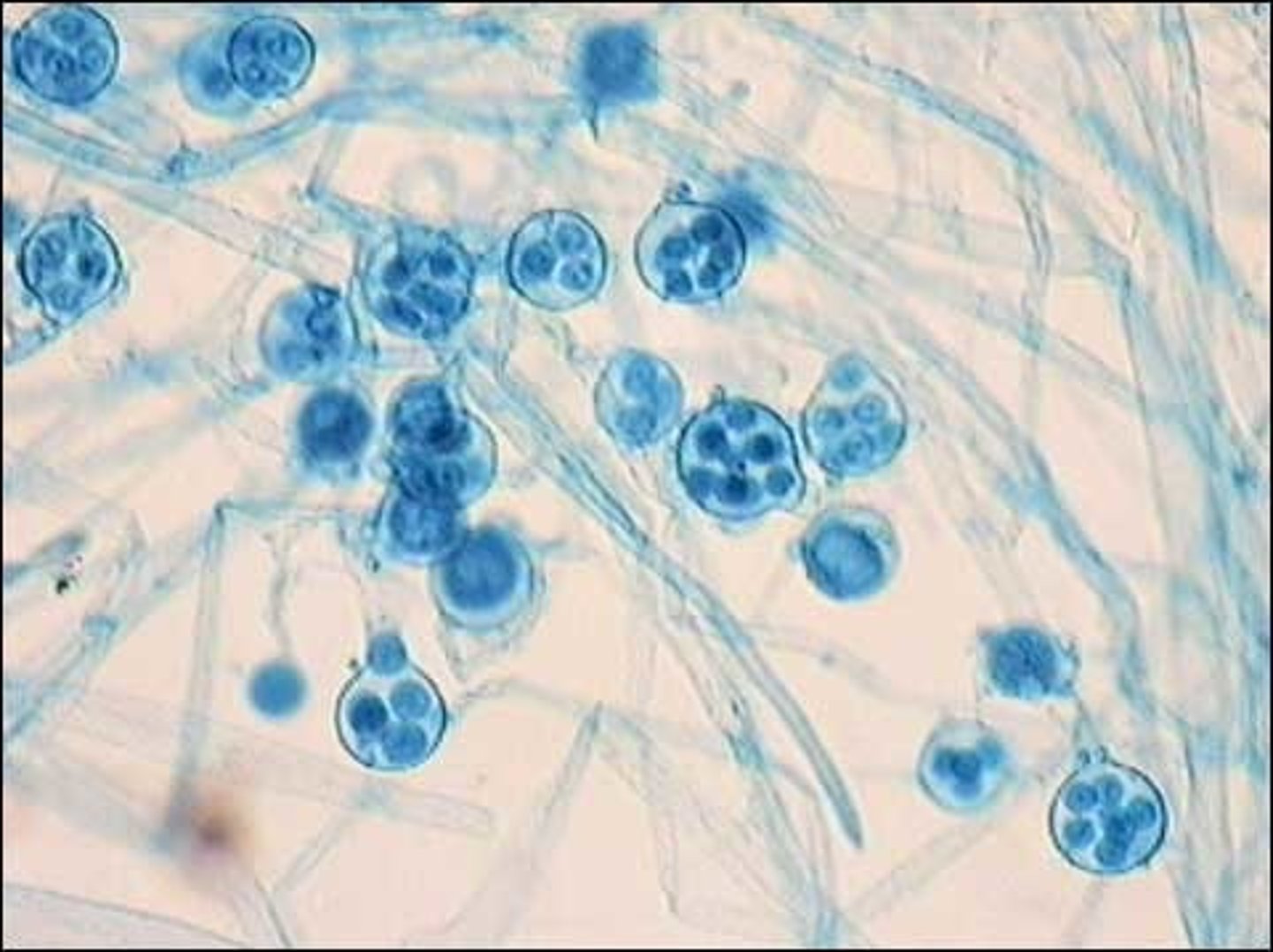 <p>Either "water molds" growing as mass of filaments (aka saprolgenia) or terrestrial plan pathogens (potato blight)</p>