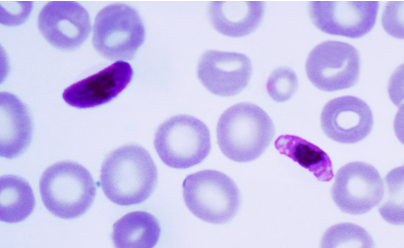 <p>This member of the Chromalveolata is a parasite and looks like shape. It’s from the apicomplexans phylum. </p>