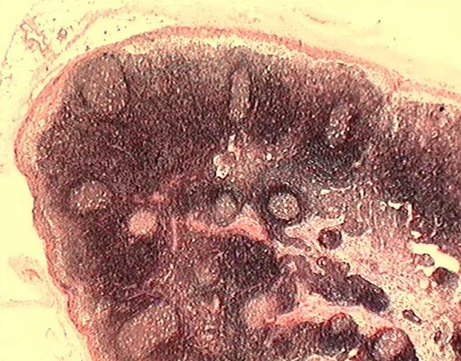 <p><strong>Lymph Nodes</strong><br><em>Capsule and subcapsular sinus observed</em></p>