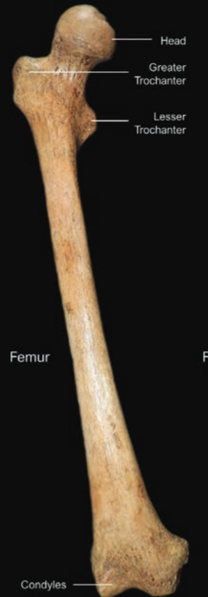 <p>Femur</p>
