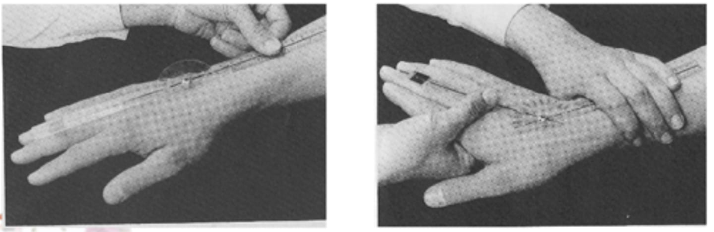 <p>III. metacarpus tengelye (NEM AZ UJJ!)</p><p>2 oldal eredményét mindig össze kell hasonítani</p>