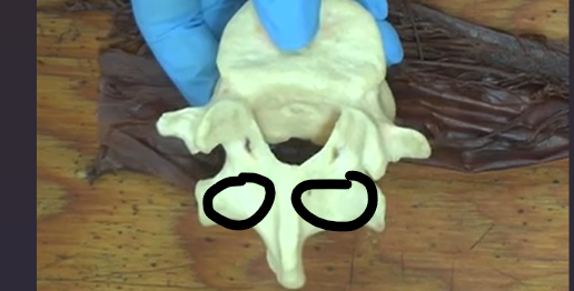 <p>A surgical procedure involving the removal of the lamina to relieve pressure or access the spinal cord.</p>