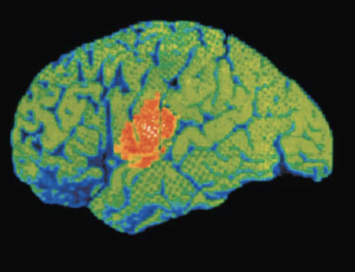 term image