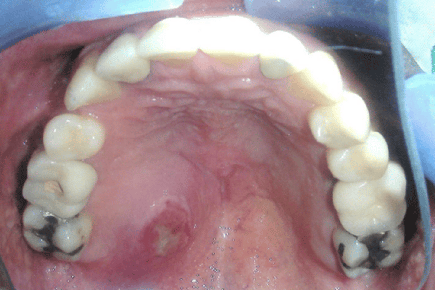 <p>ID the pathology:</p>