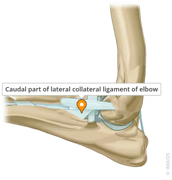 <ol><li><p>Stabilises lateral side.</p></li><li><p>Attached proximally to lateral humeral epicondyle &amp; distally it divides into cranial (insert on radius) &amp; caudal (insert on ulna)</p></li></ol><p></p>