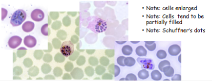 <p>What is the genus, species, and stage of this parasite?</p>