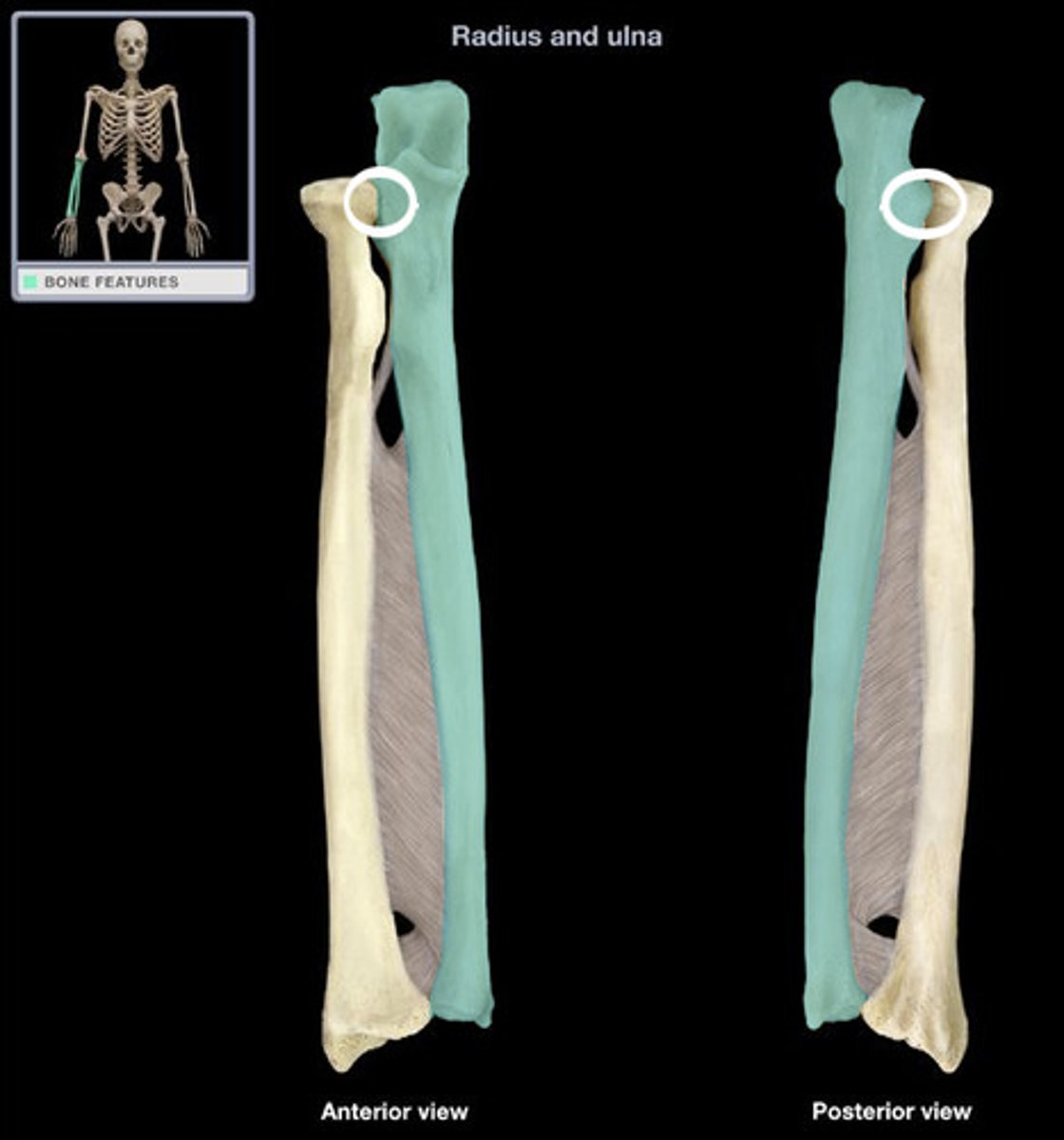 <p>Lateral to the coronoid process<br><br>Articulates with the head of the radius</p>