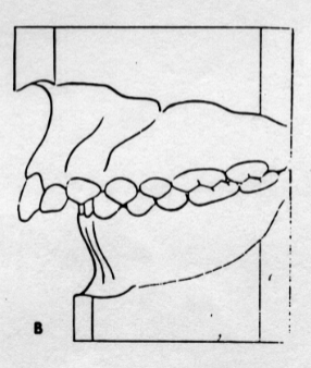<p>Class II, Division I</p>