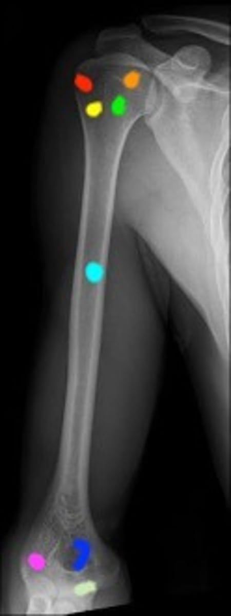 <p>Above the shoulder and below the elbow</p>