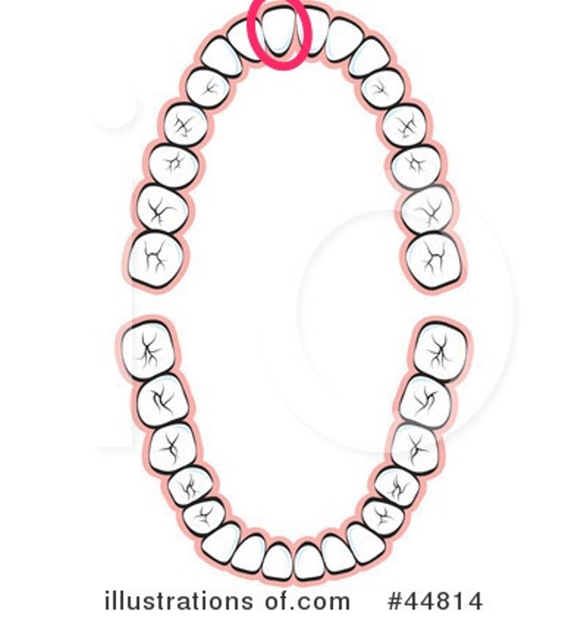 <p>UR central incisor</p>
