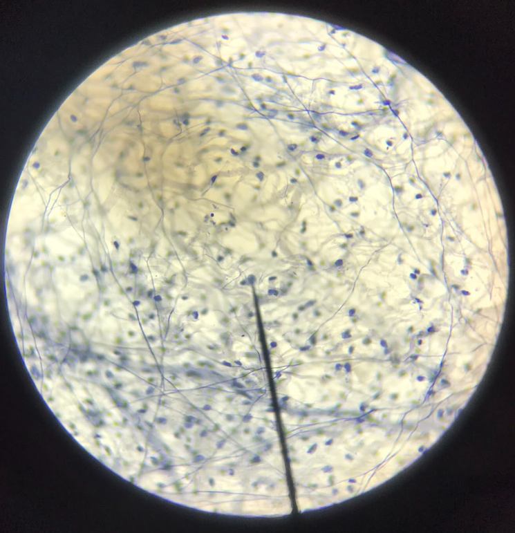 <p>serves as a filling tissue; contain less amount of fibers but with greater amount of ground substance, and greater number of cells</p>