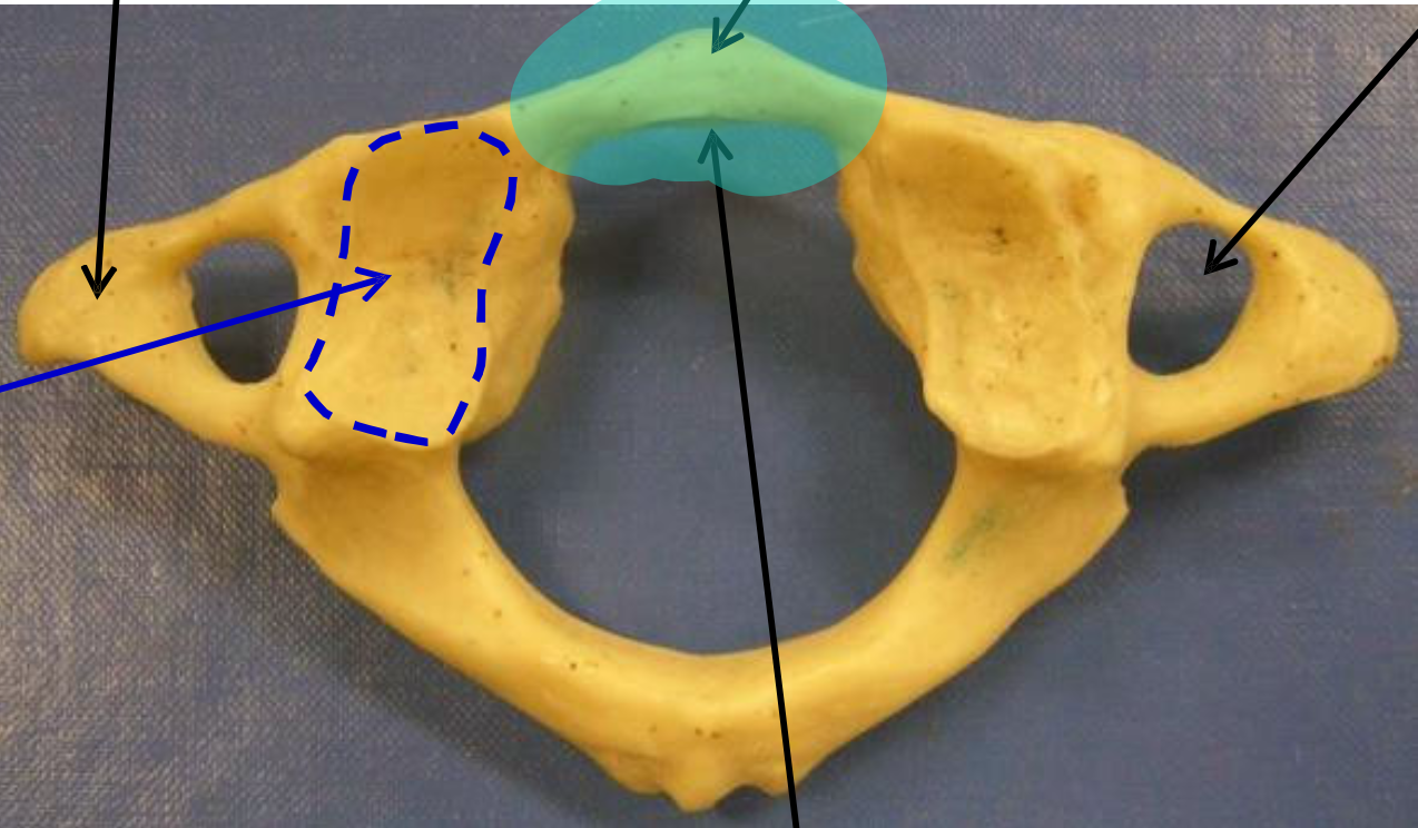 <p>Name the highlighted structure.</p>