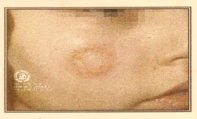<p>Disease;caused by?</p><p></p>