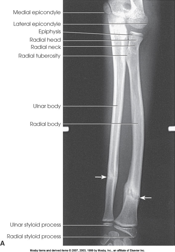 <p>What position is demonstrated?</p>