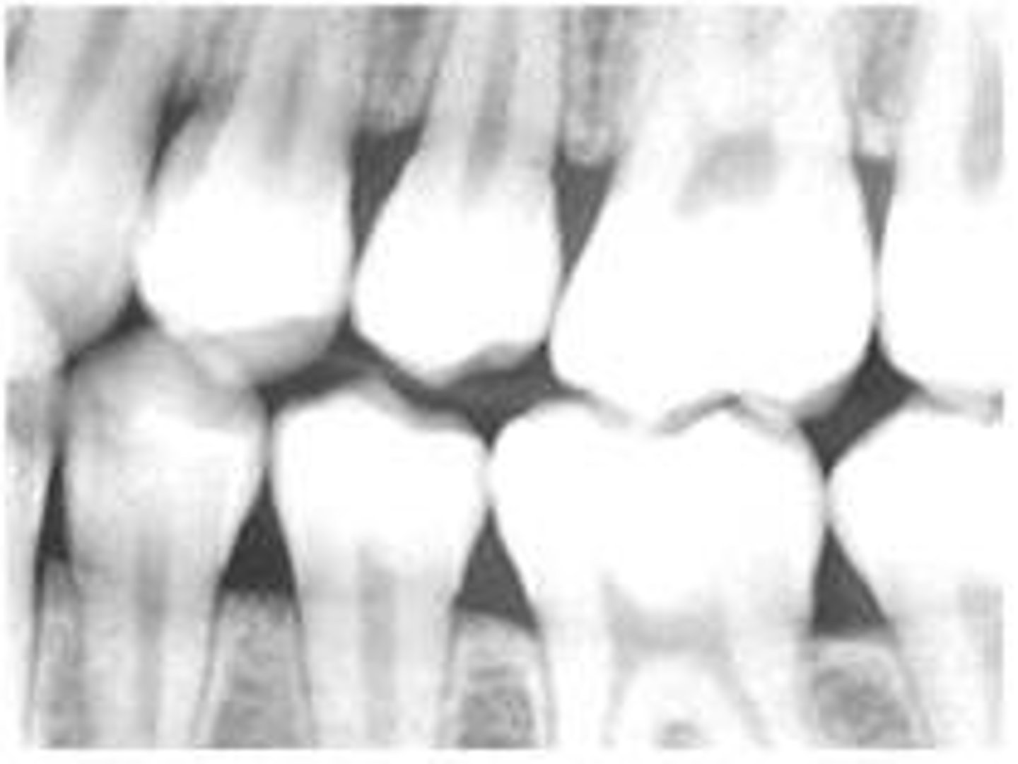 <p>film too light</p>