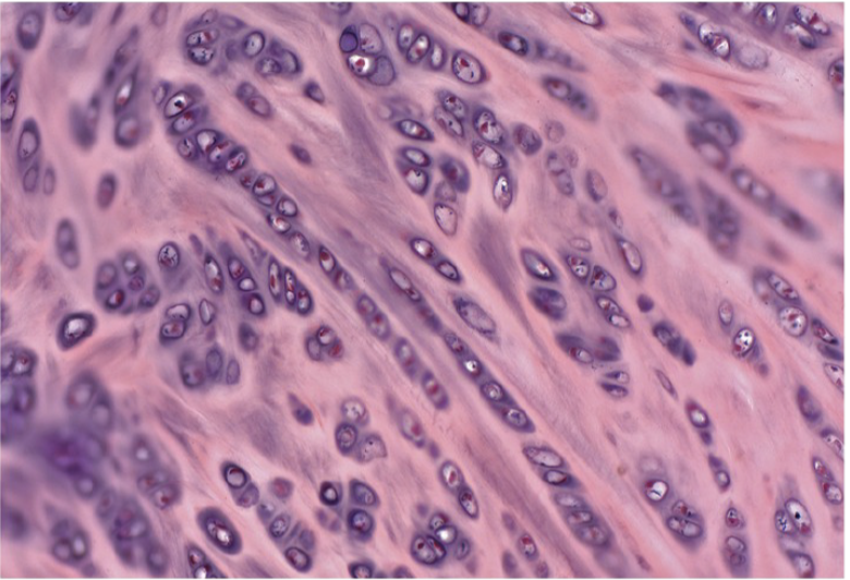 <p>Fibrocartilage</p>