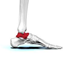 <p>what bone is this?</p>