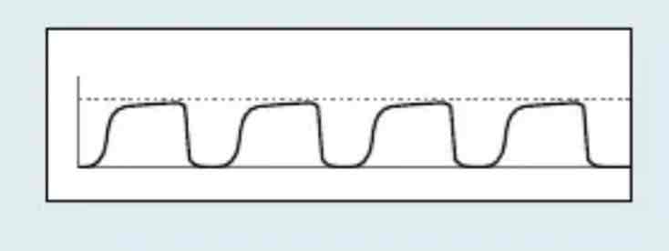 <p>which Capnography waveform is this</p>