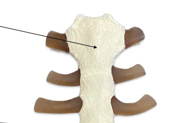 <p>What bone is the base of the neck?</p>