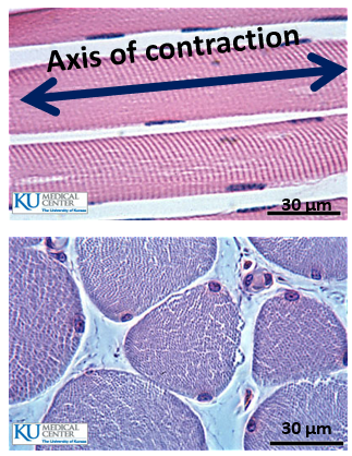 <ul><li><p>multi-nucleated (each cell has multiple nuclei) on periphery of cell body</p></li><li><p>has a single axis of contraction (when stimulated, will contract along that axis only)</p></li></ul><p></p><p>Top image = longitudinal section of muscle</p><p>Bottom image = cross section of muscle</p>