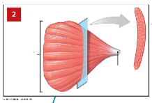 <p>arrow, bracket (type of muscle)</p>