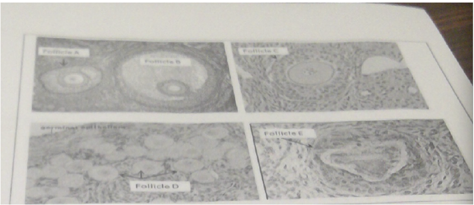 24\. Which of the follicles shown in the attachment determine the length of the follicular phases of the menstrual cycle