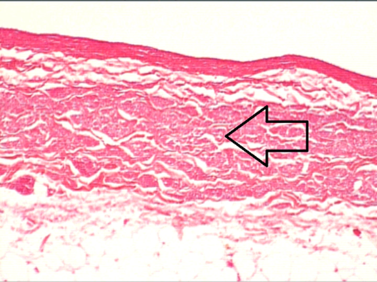 <p>T/F: This is a large vein since it contains thick tunica adventitia.</p>