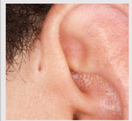 <p>What is this disorder</p>