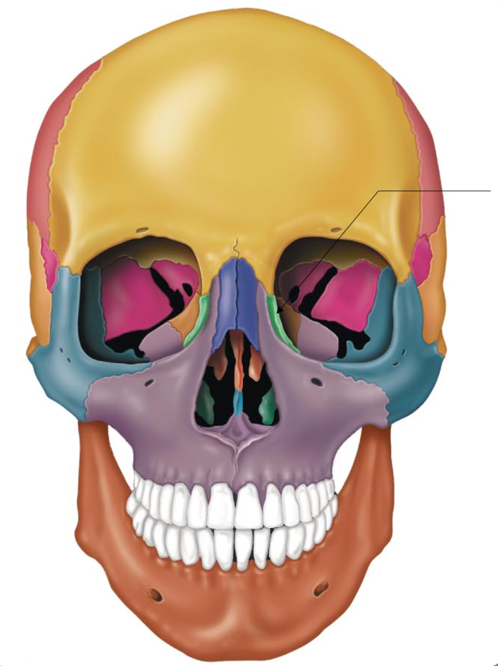 term image