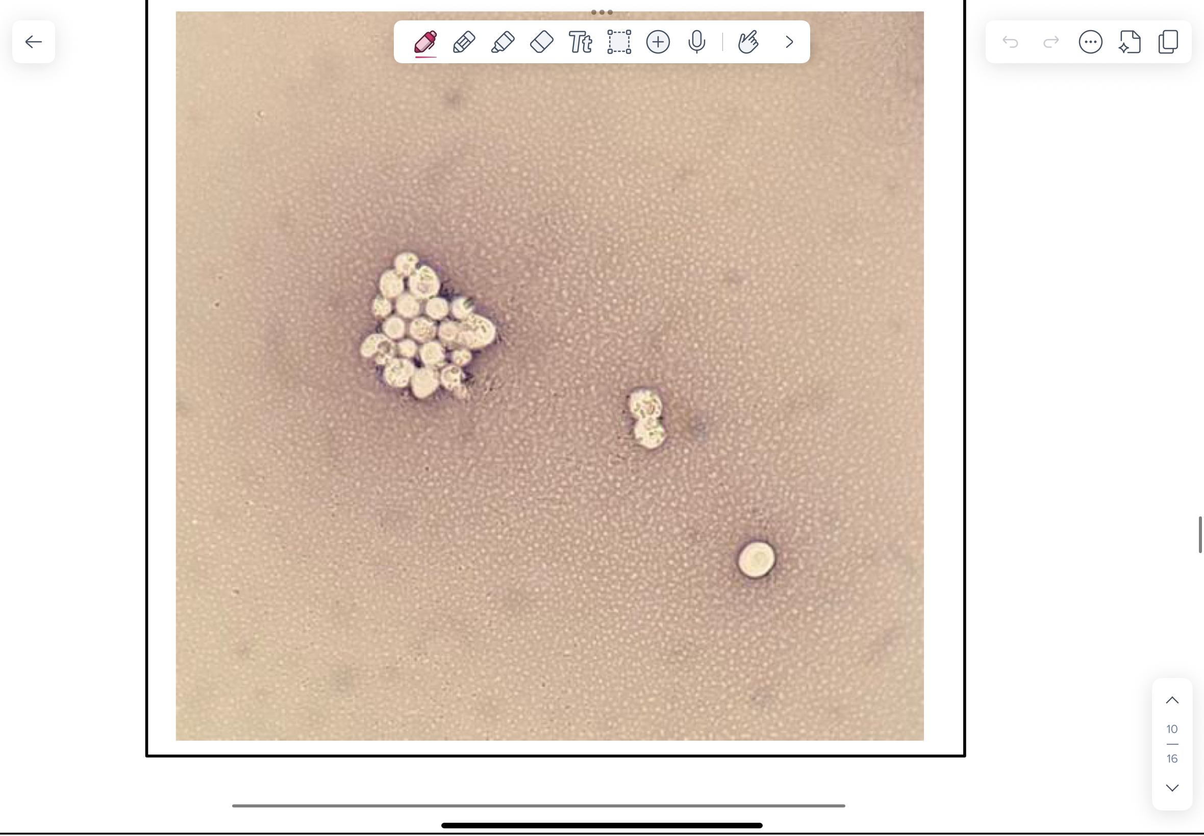 <p>NOTE the characteristic thick capsule and asymmetrically dividing yeast.</p>