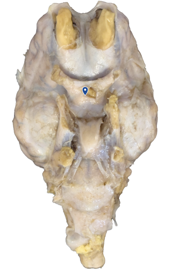 <p>What structure is formed by the joining of the two cranial nerves?</p>