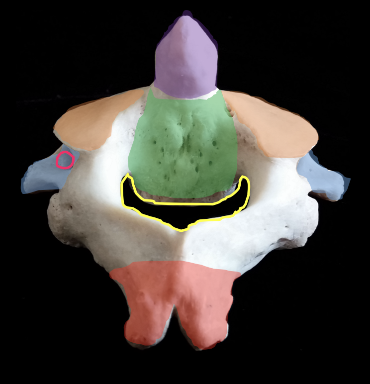 <p>coral portion</p>