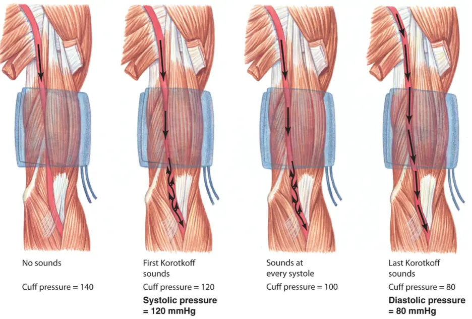 <p>Pressure at which all blood can get past cuff (i.e. even when blood is at lowest pressure) gives diastolic pressure</p>