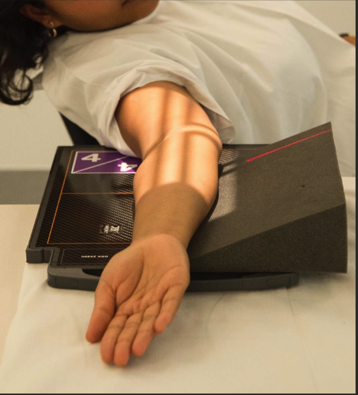 <ul><li><p>Long edge elbow parallel long edge IR.</p></li><li><p>Start in AP position then rotate arm externally so epicondyles are 30-35 degrees oblique to IR (patient might need to lean back to aid it).</p></li><li><p>Hand, elbow, and shoulder still on same horizontal plane.</p></li><li><p>No angle on CR (perp. to IR).</p></li><li><p>Collimate to include both 8-10cm of proximal forearm and distal humerus.</p></li><li><p>Centre at cubital fossa.</p></li></ul><p></p>