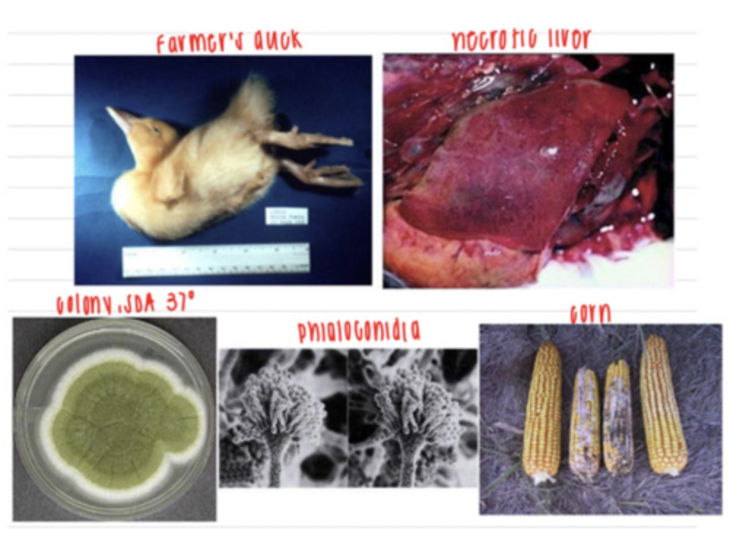 <p>a farmer brings in a duckling on his farm that he noticed was experiencing ataxia, opisthotonos (muscle spasms), and then suddenly died. the vet does a necropsy and observes aplasia of the thymic cortex and necrosis of the liver. the farmer says that the corn that the animals have been eating does look a little moldy, so he brings in one for examination. the vet isolates some cells from the corn on SDA at 37 degrees and observes the colony and the phialoconidia that has grown. what is the diagnosis?</p>