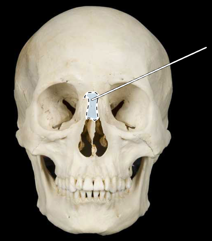 <p>Name this bone.</p><p>(Skull, anterior view).</p>