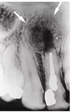 <p>what is the diagnosis?</p>