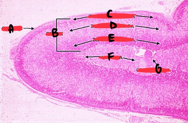 <p>B</p>
