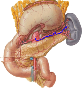 <p>name the artery highlighted</p>