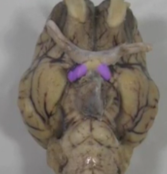 <p>Optic tract </p>